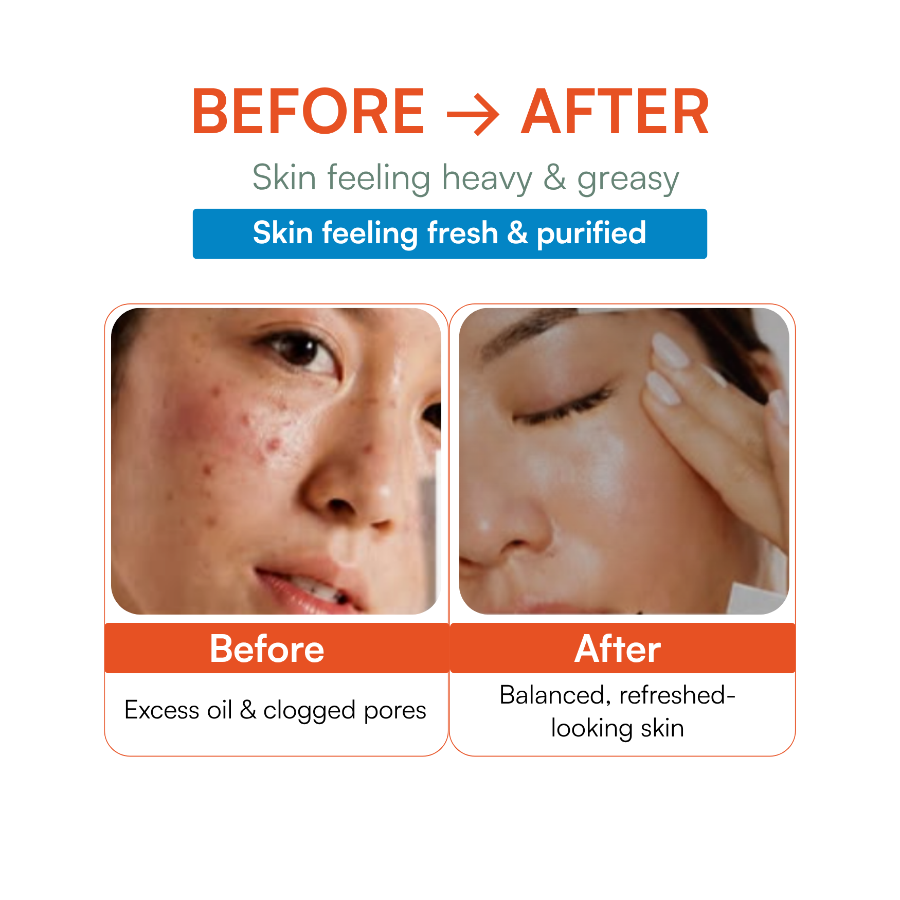 Anti Acne Face Wash
