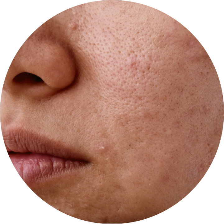 Skin Health