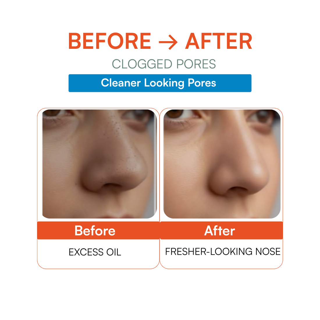 Deep Pore Charcoal Nose Strips