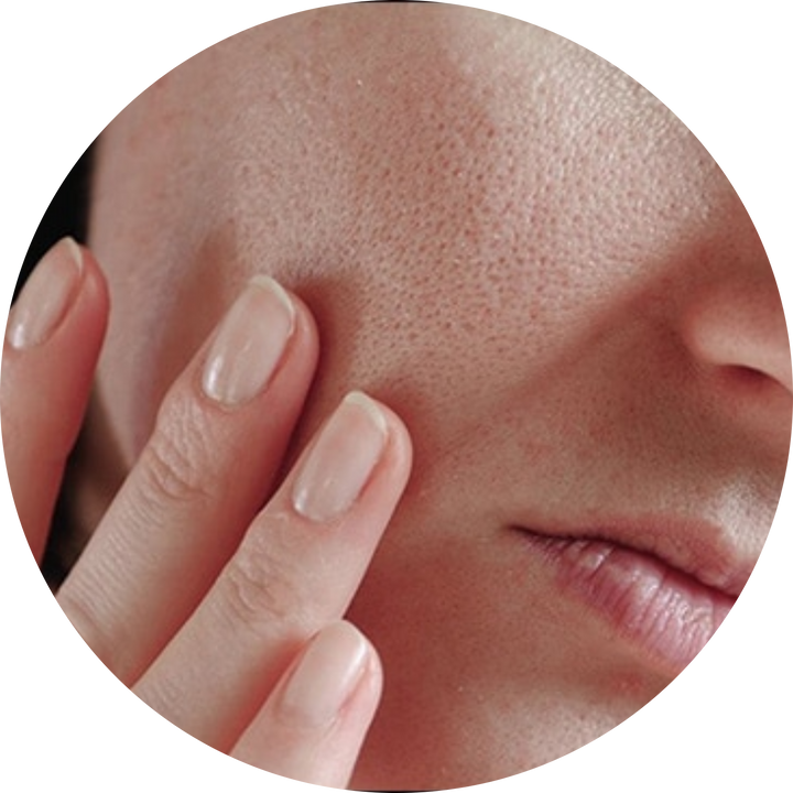 Dry Skin